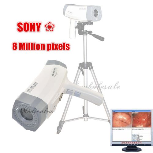 Digital electronic colposcope sony camera 800,000 pix gynecology ce fda ca sale for sale