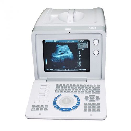 Ce approved portable full digital ultrasound scanner+convex probe+ free 3d for sale