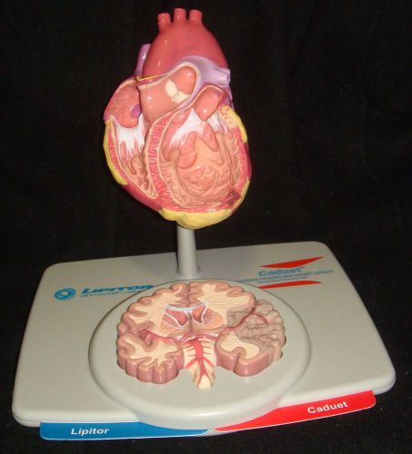 Heart and Brain Pathology Anatomical Model Shows Left Heart Failure and Stroke