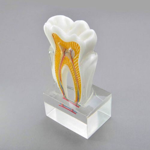 Dentalmall Dental Model #4019 01 - Anatomical Molar Model