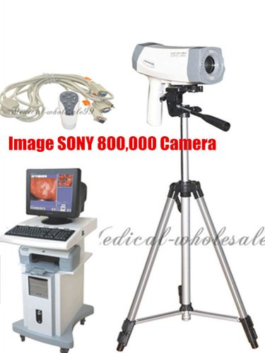 Hot sale digital electronic colposcope sony camera 850000 pix gynecology ce fda for sale