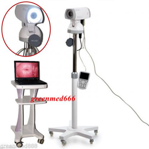2015 digital electronic colposcope gynecologic exam sony camera 830,000 pixel-5 for sale