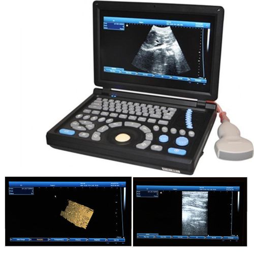 in 3D Full Digital Laptop Ultrasound Scanner (PC) with convex probe Free Ship