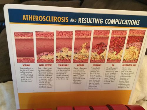HEALTH CARE MODEL **ATHEROSCLEROSIS AND RESULTING COMPLICATIONS** (ABBOTT LABS)