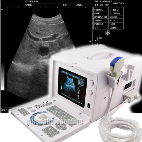 Digital ultrasound scanner machine portable --3.5 mhz convex probe --ext 3d for sale