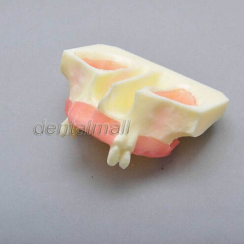 Dentalmall Dental Model #2013 01 - Sinus Lift Practice Model