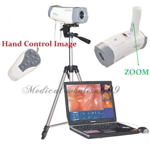 2015 new digital video electronic colposcope+ sony camera software+high image ce for sale