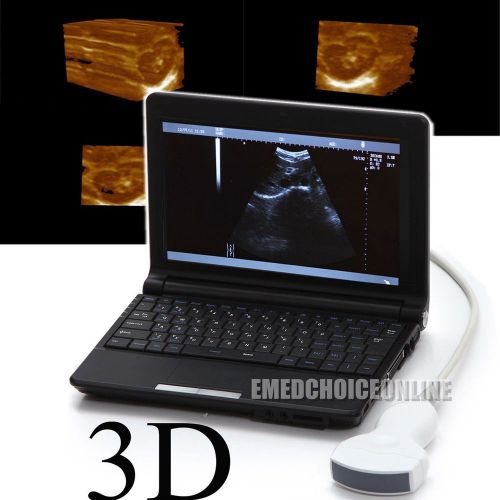 Laptop *3D* Digital Portable Ultrasound machine VGA+ Scanner + 3.5 convex probe