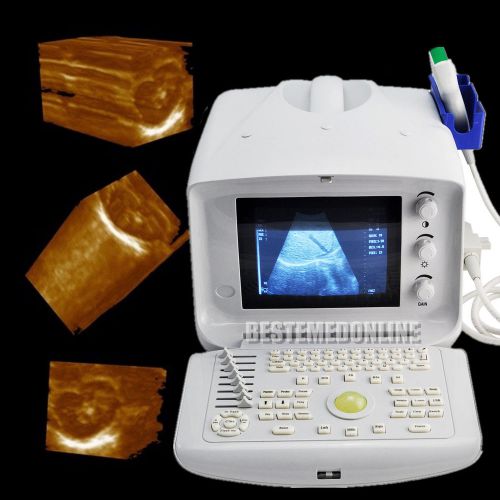 Ce portable digital ultrasound scanner 3.5 mhz convex probe external 3d image for sale