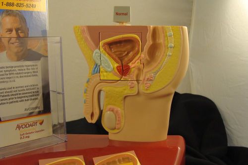 Medical Display Model Half Penis Prostate Gland Rectum Glaxo Smith Kline