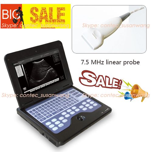 Sale Promotion B-Ultrasound Diagnostic scanner System with 7.5mhz linear probe