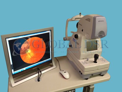 Topcon TRC NW200 Non Myd Fundus Camera w/ Windows 7 + Lombart Digital Video Sys.