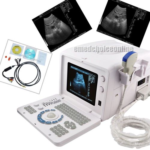 New ce svga portable full digital ultrasound scanner 3.5mhz convex 3d software for sale