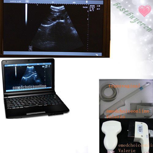 Item 10.1&#039; laptop ultrasound-scanner ultrasound system 3d*convex+ trans-vaginal for sale