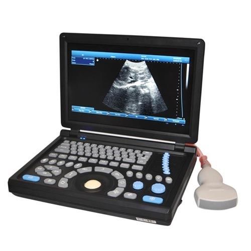 10.4&#034; 3D Digital Laptop Ultrasound Scanner (PC) with Convex Probe Color LCD