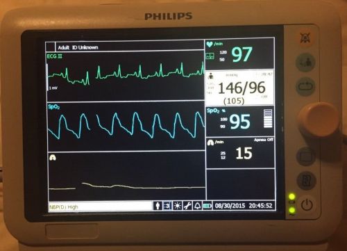 Philips vms series transport monitor bp, spo2, ecg monitor for sale