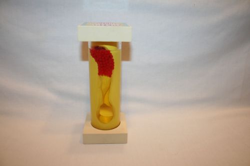 HEALTH EDCO Clogged Occluded Artery Model cholesterol plaque RM96146