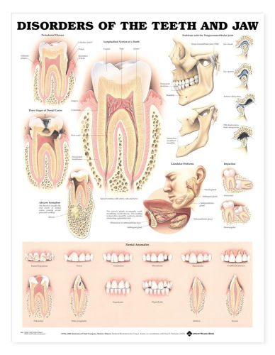 Disorders of the Teeth and Jaw Dental * Anatomy Poster * Anatomical Chart Comp.