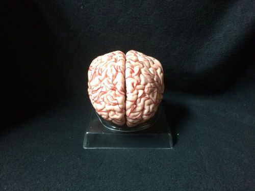 SOMSO Brain Model with Arteries BS23 Anatomical Model
