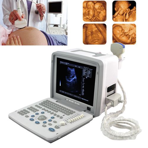 3d full digital portable ultrasound scanner convex probe 3d workstation fda ce for sale