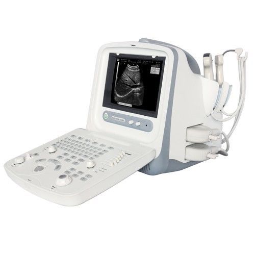 CHISON 8300 Portable Ultrasound w/ 1 probe (choice of linear or convex probe)