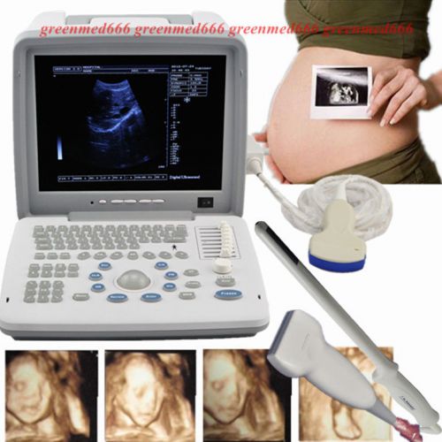 3d full digital portable ultrasound scanner +convex&amp;linear&amp;transvaginal 3 probes for sale