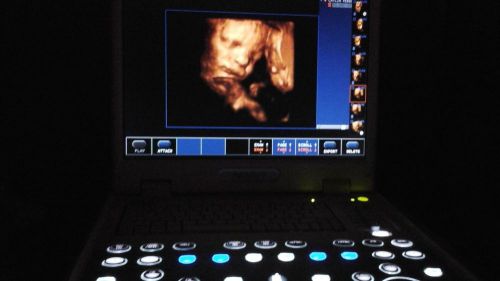 3d/4d ultrasound Biosound Mylab 30 CV Gold (training included)