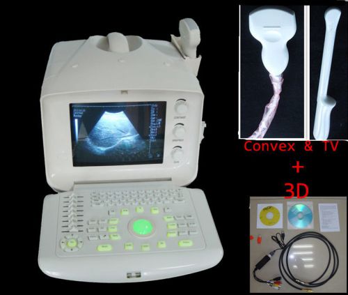 3d ultrasonic scanner diagnostic machine + convex &amp; tv transvaginal probe abdmen for sale