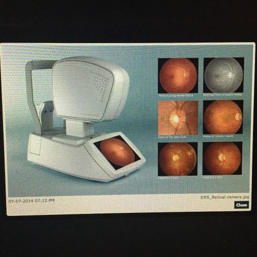 DRS Centervue Retinal Camera