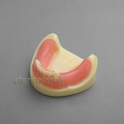 Dental Model #2009 01 - Lower Jaw Implant Practice Model with Gingiva