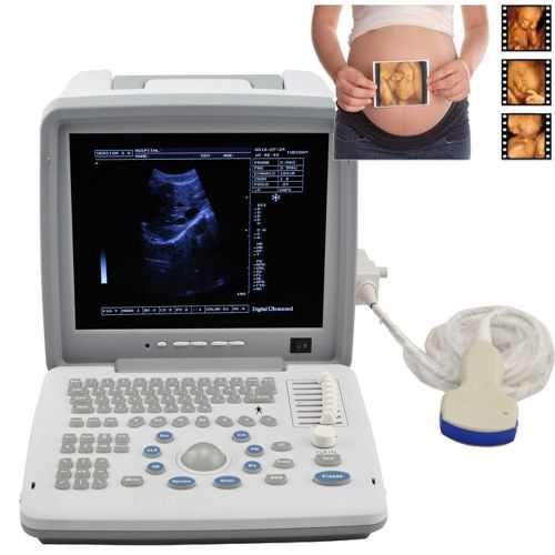 12.1 ce led full digital portable ultrasound scanner + convex + 3d workstation for sale