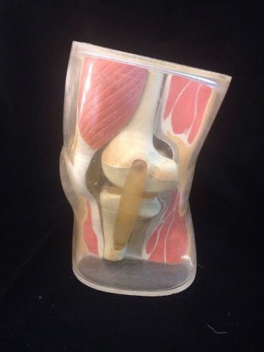Vintage Antique Transparent Human Knee Anatomical Model, 5 part