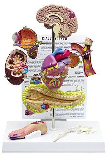 Diabetes Type II Anatomy Mini Model Set Brain Heart Eye Kidney Foot  #4010 **