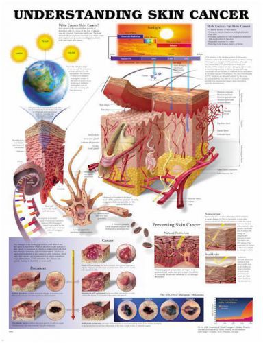 Understanding Skin Cancer *  Derm * Anatomy Poster * Anatomical Chart Company
