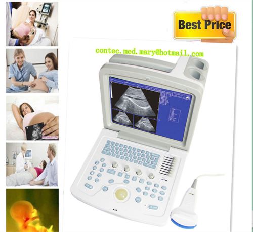 Ce,cms600b-3 digital portable ultrasound scanner machine with 3.5 convex probe for sale