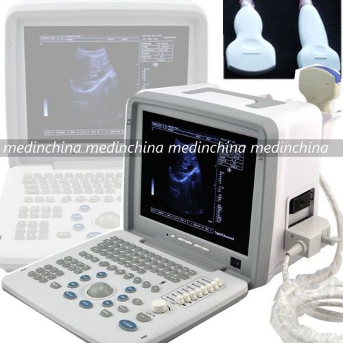 Full digital laptop ultrasound scanner+convex+ transvaginal probe+ external 3d for sale