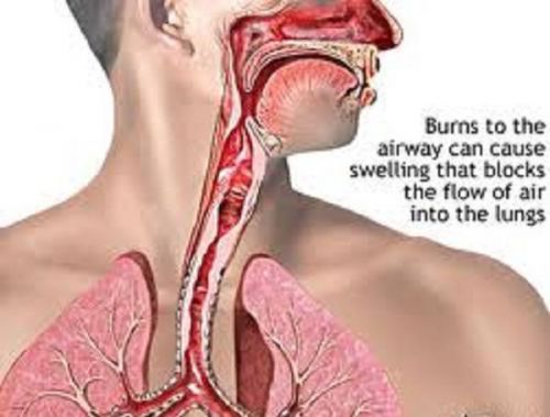 Airway management/assessments &amp; examinations on video 2 dvds for sale