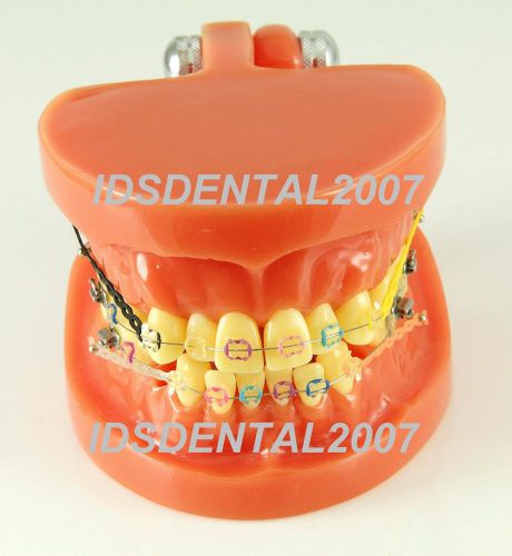 Dental Orthodontics ORT Demonstration Teeth Model NEW BEAUTIFUL