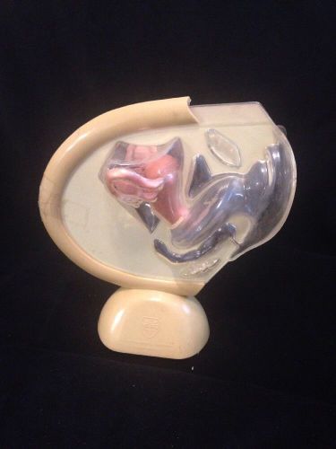 Vintage Ortho Female Pelvis Vagina Cervix Ovaries Anatomical Model Human AS IS