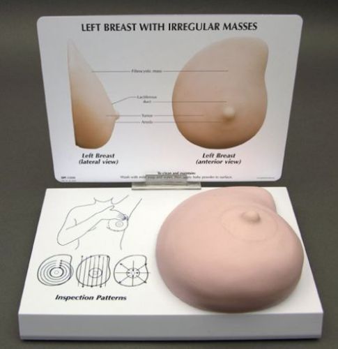 NEW Female Breast- Left Breast with Cancer Anatomical Model