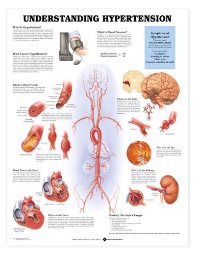 Understanding Hypertension * Anatomy Poster * Anatomical Chart Company