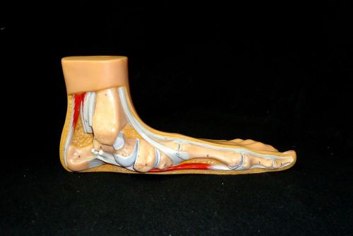 SOMSO Flat Foot (Pes Panus) Anatomical Teaching Model NS2