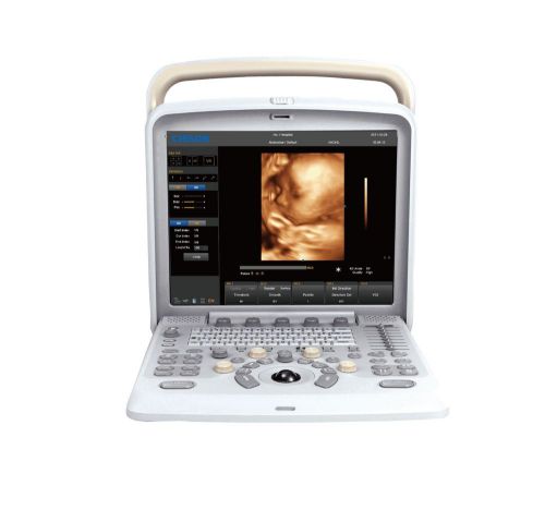 Chison q5 color doppler ultrasound scanner&amp; 4d probe and software demo model for sale