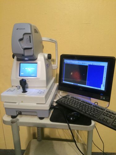 Topcon NW100 Fundus Camera complete with computer and Imagenetlite