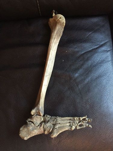 Halloween-Anatomy-Right Lower Extremity Articulated specimen