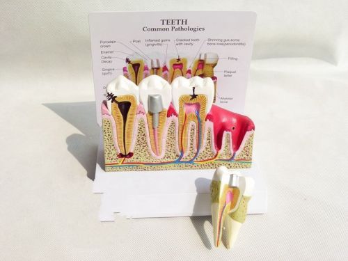 1Pc  Teeth Anatomical Model Oversized Anatomy 16.5*11.5*11CM