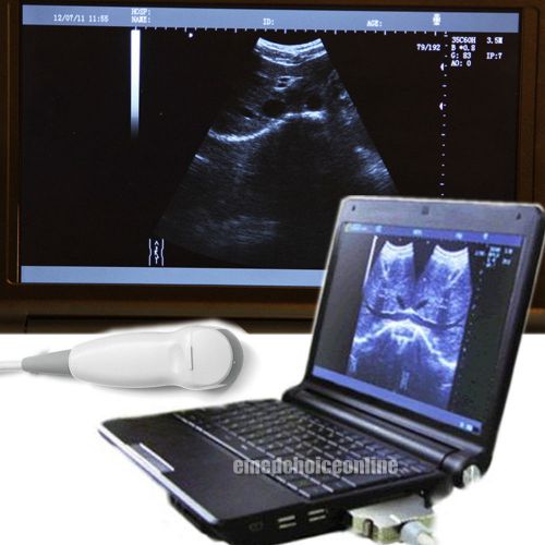 Digital laptop ultrasound scanner machine with 5.0 micro-convex probe + 3d + vga for sale