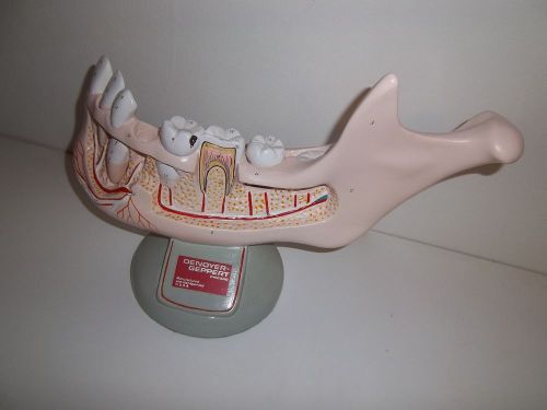 Denoyer-Geppert  anatomical model preadolescent lower jaw removable teeth