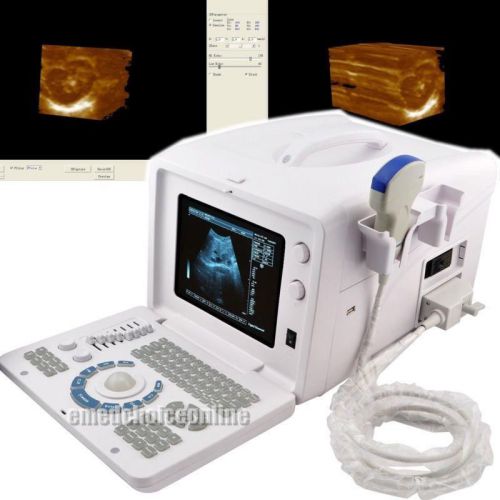 Sale!!new digital ultrasound scanner portable machine *convex probe *3d software for sale