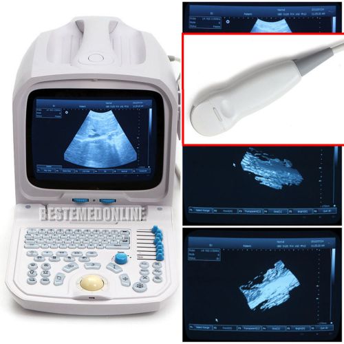 3D PC based platform Full Digital ultrasound scanner micro convex cardiac probe